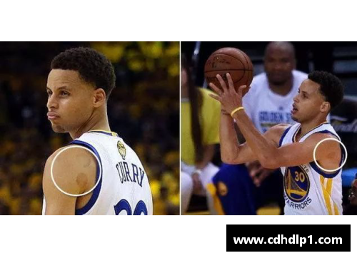 jbo竞博官网NBA球员拔火罐：健康潮流还是趋势风险？ - 副本